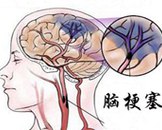 教学图示卡通漫画