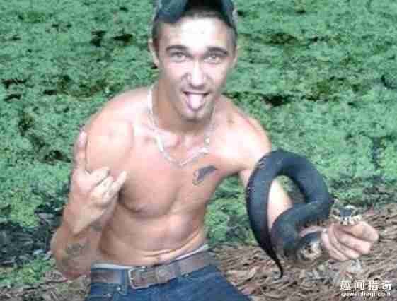 男子亲吻宠物蛇|却被蛇咬成猪头!