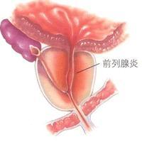 影响到生活质量和夫妻