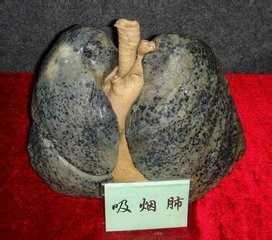 抽烟肺吸烟人的肺图片