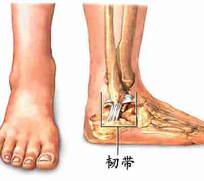 兄弟|脚踝不灵活会影响你约跑