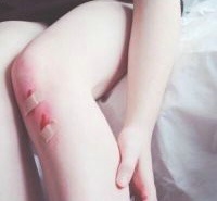 受伤了重口味病态女生头像