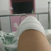 膝盖受伤图片真实照片 在医院躺着膝盖受伤真实图片
